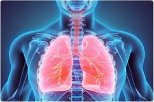 Faulty-gene-puts-1-in-3000-people-at-risk-of-developing-holes-in-their-lungs-Study