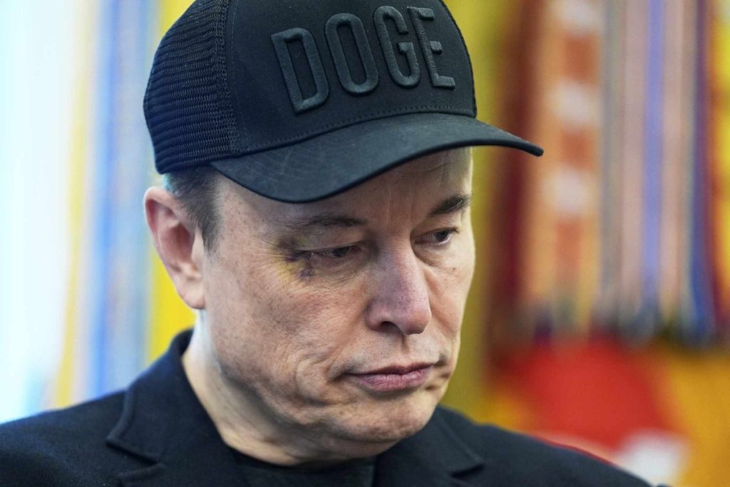 एलन मस्क की काली और सूजी आंख का क्या है राज़? किसने किया पंच