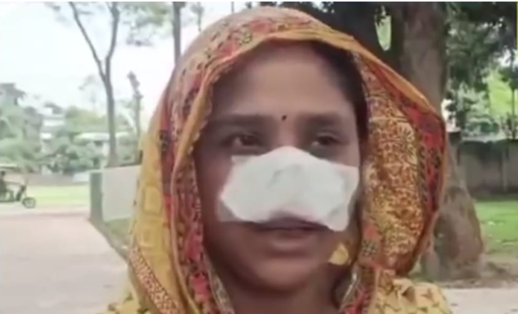 man-cuts-off-wife-nose-eats-it-bapan-sheikh-case-filed