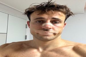 Social-media-trend-of-putting-tape-over-mouth-while-sleeping-may-pose-serious-risk-Study