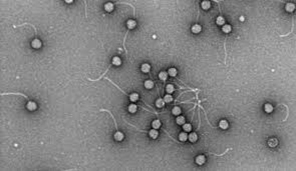 निमोनिया पैदा करने वाले कीटाणुओं में छिपा है एक अहम वायरस, अध्ययन में खुलासा