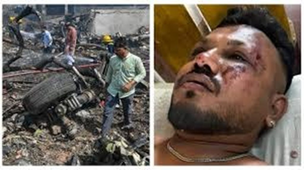 “मुझे खुद भरोसा नहीं, मैं कैसे जिंदा निकला” विमान हादसे में बच­ने वाले विश्वास कुमार की दास्तान