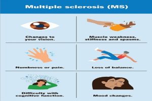 Multiple-sclerosis-may-occur-even-a-decade-before-symptoms-Research!