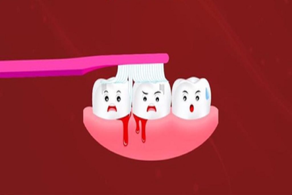 मसूड़ों से खून आना शरीर की गंभीर अंदरूनी बीमारियों का संकेत!