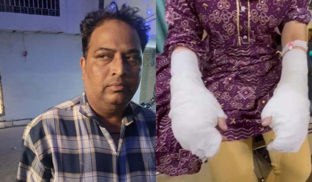 ‘एसिड अटैक’ का मामला निकला झूठा: पिता अक़ील खान ने रचा था षड्यंत्र!