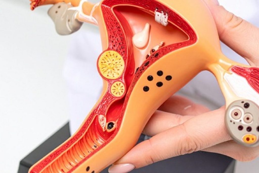 ‘महिला प्रजनन तंत्र’ की अनदेखी पड़ सकती है भारी, इस तरह करें बेहतर देखभाल!