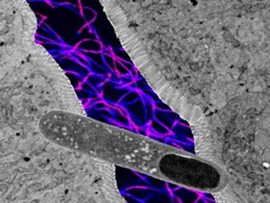 अमेरिकी वैज्ञानिकों ने ढूंढ निकाला ऐसा गट बैक्टीरिया जो वजन कम करने में भी मददगार