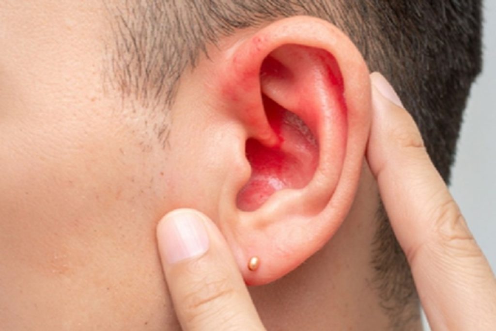 कान की सेहत से आप भी तो नहीं कर रहे खिलवाड़? बड़े काम के हैं ये टिप्स​!