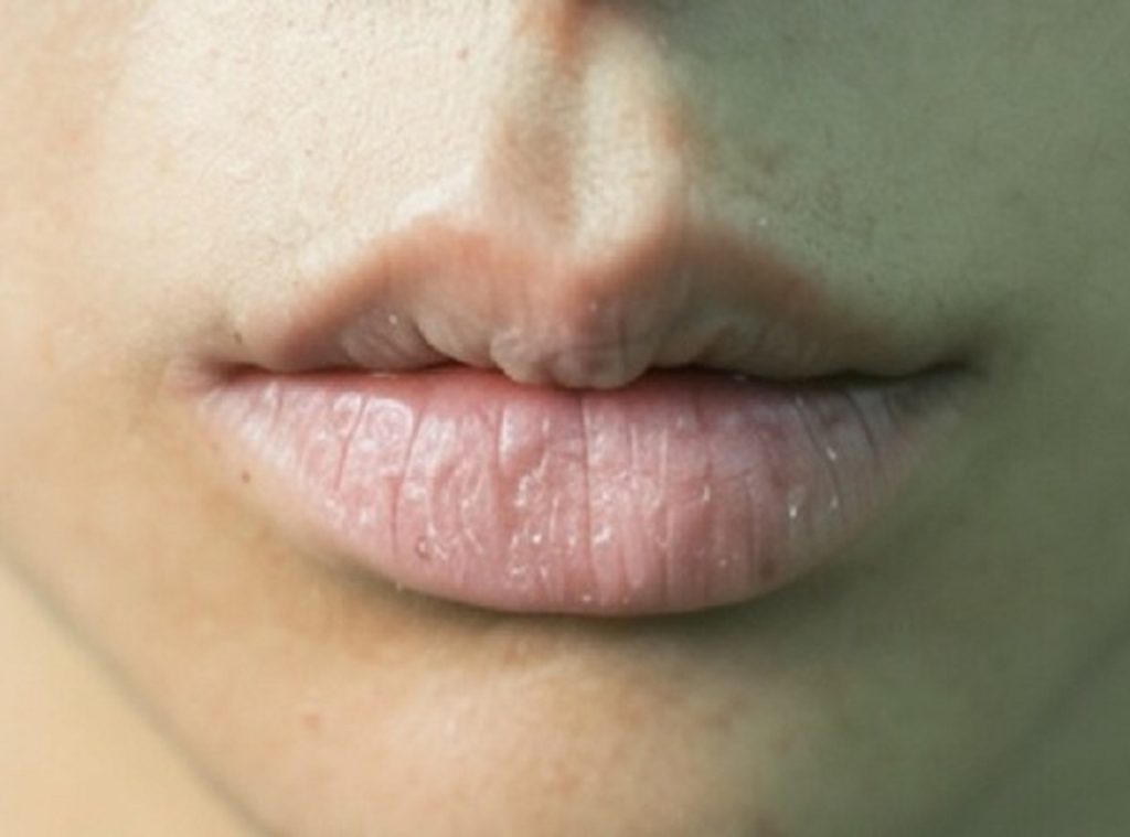 फटे होंठ से लेकर झुर्रियों तक, इन चीजों को वैसलीन में मिलाकर उपयोग करने से मिलेगा आराम