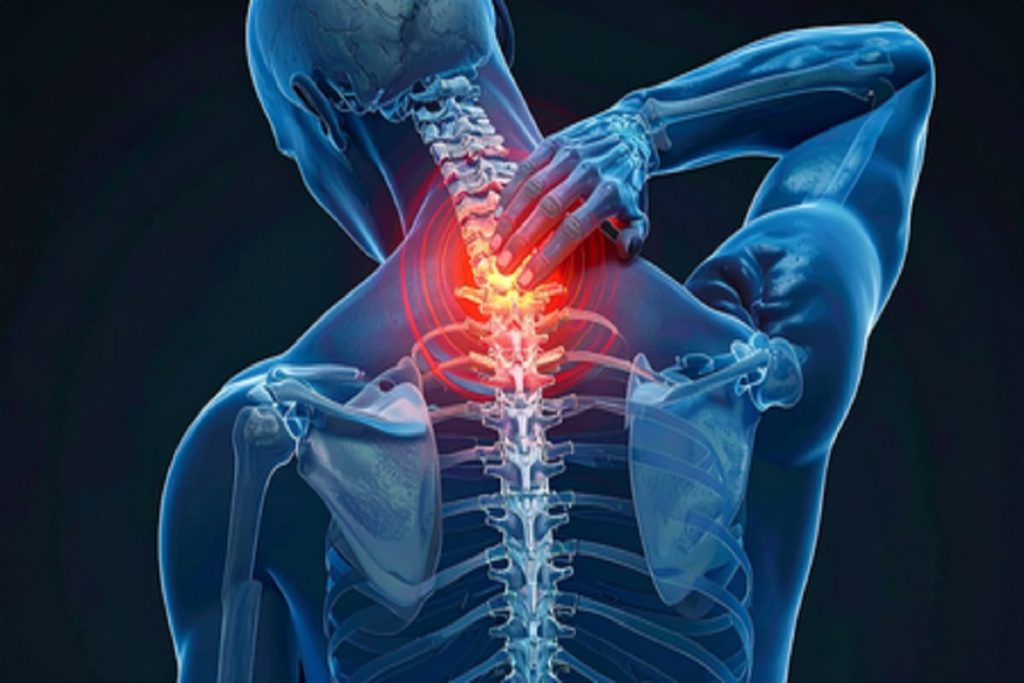 लाइफस्टाइल बदलाव से सर्वाइकल स्पॉन्डिलाइटिस कंट्रोल, जानें लक्षण कारण और उपाय